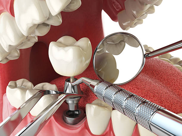 Reliable NC Emergency Dentist Solutions